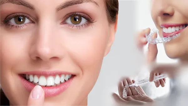 dịch vụ nha khoa thẩm mỹ