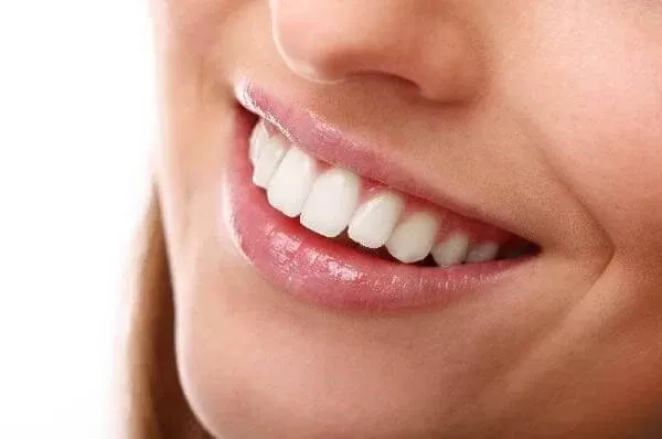 ưu điểm của bọc răng sứ thẩm mỹ