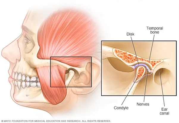 Rối loạn khớp thái dương hàm là gì? Nguyên nhân, cách xử lý 6 Điều trị chứng rối loạn khớp thái dương hàm