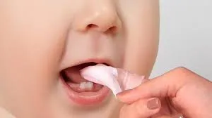 Điều trị nấm miệng ở trẻ sơ sinh