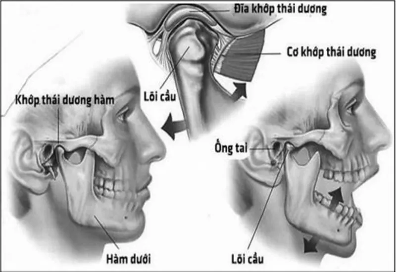 Rối loạn khớp thái dương hàm là gì? Nguyên nhân, cách xử lý