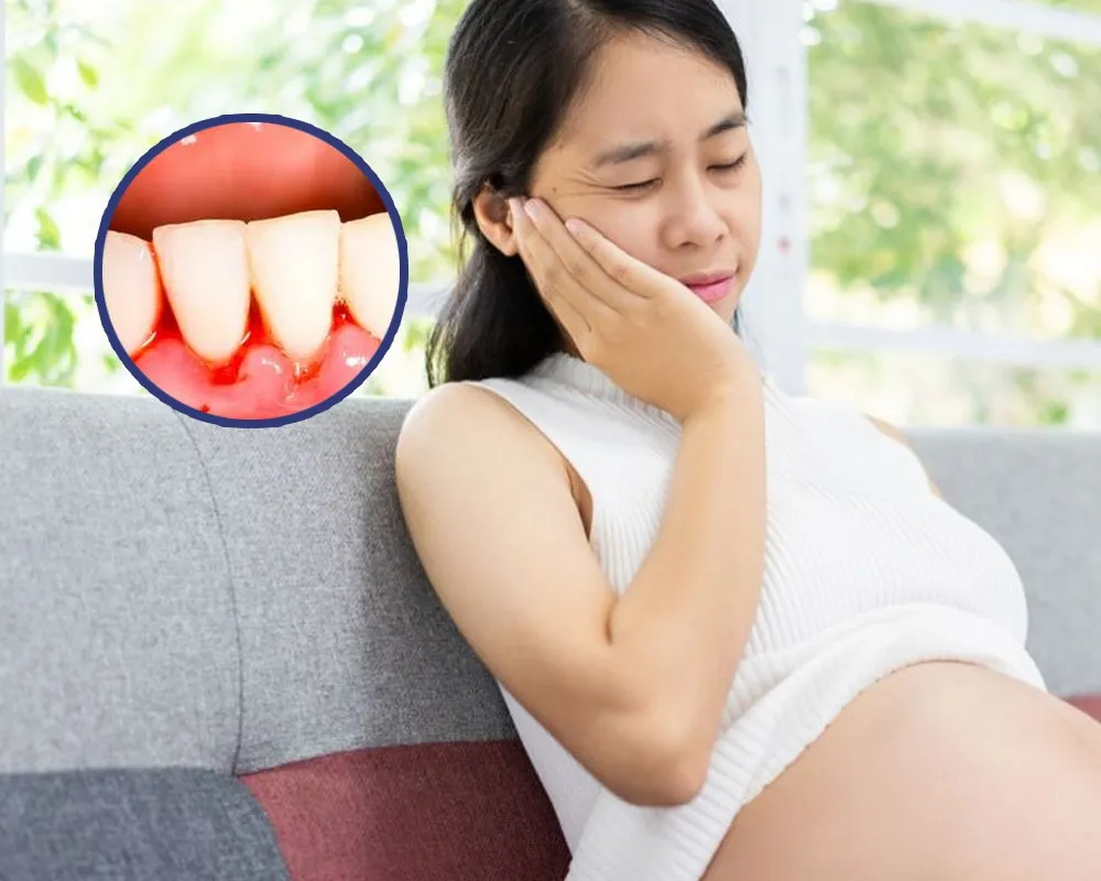 Bầu bị chảy máu chân răng : Nguyên nhân và cách điều trị 6 Cách chăm sóc răng miệng khi bầu bị chảy máu chân răng