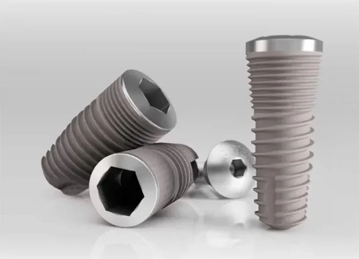 Cấy ghép Implant Hàn Quốc có tốt không