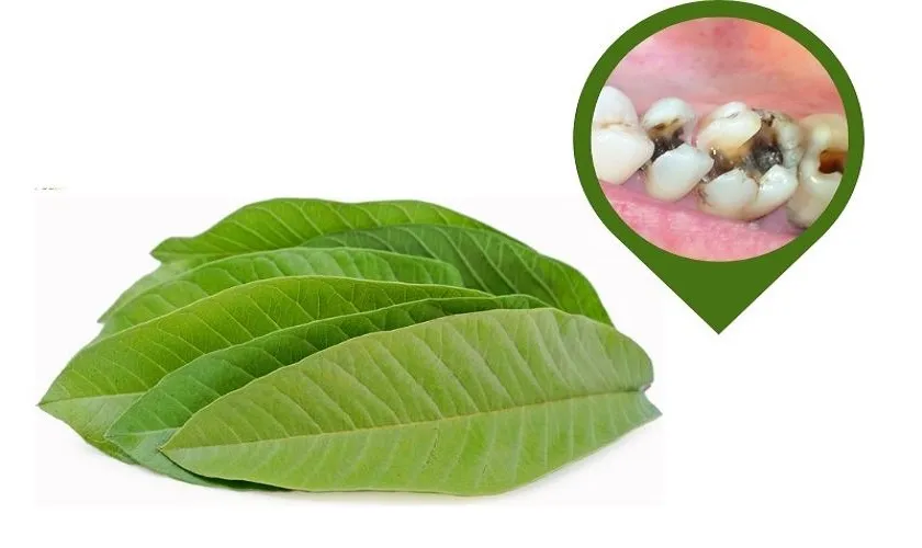 Mẹo chữa đau răng sâu bằng lá ổi