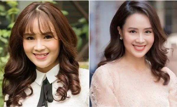 Niềng răng có làm mặt nhỏ lại không