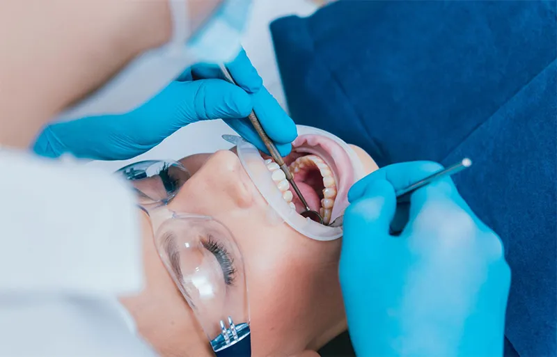 Lấy cao răng và Thổi cát
