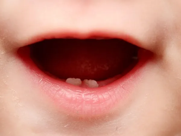 Trẻ mọc răng sớm có sao không