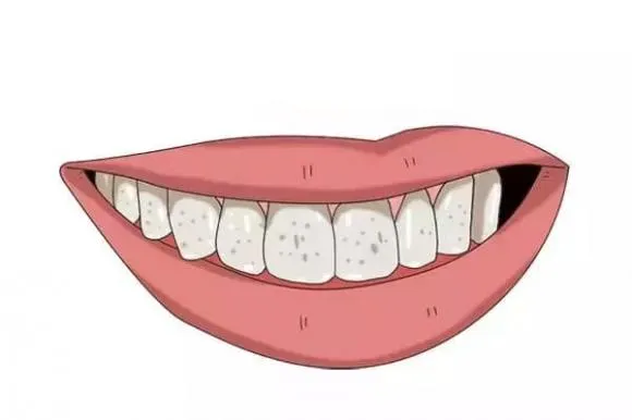 răng có vết đen