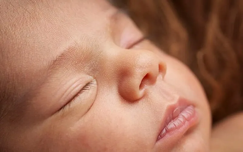 Môi bé bị bợn trắng là bệnh gì? Nguyên nhân và cách xử lý 8 Cách Phòng Ngừa Môi Bé Bị Bợn Trắng
