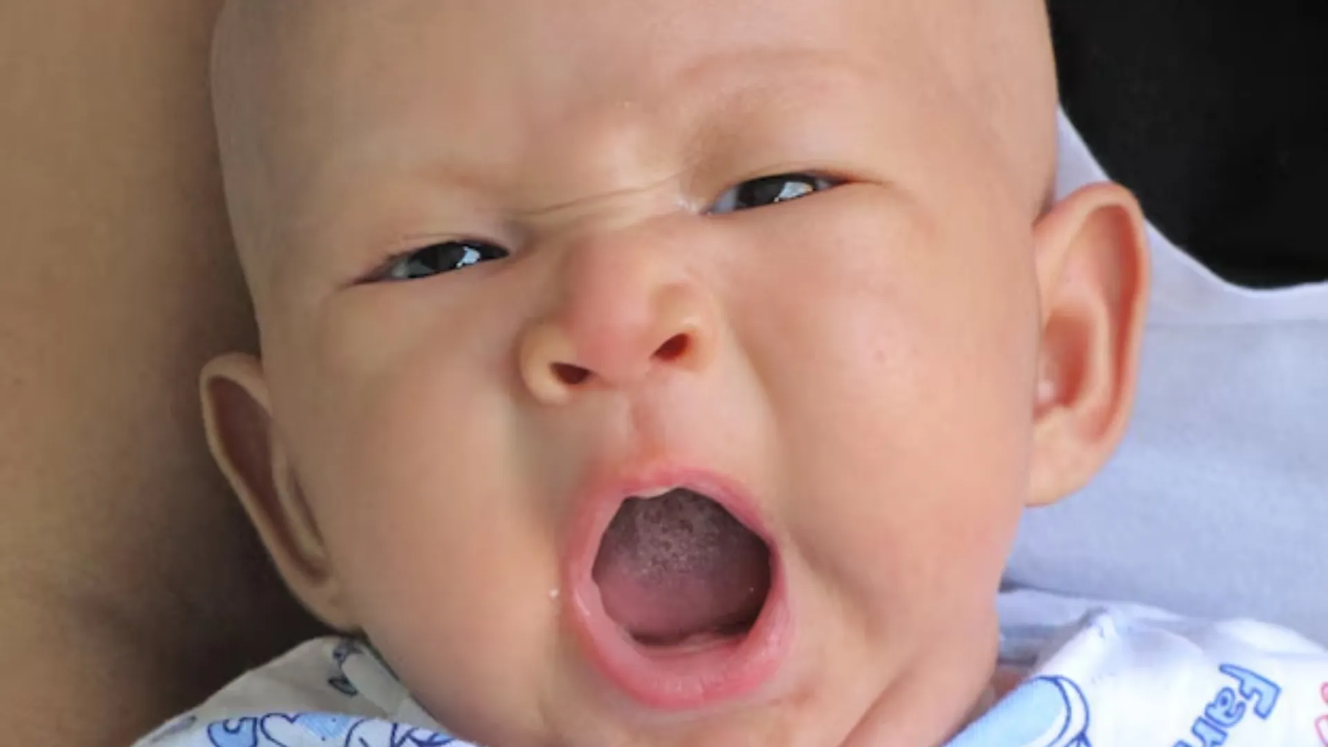 Môi bé bị bợn trắng là bệnh gì? Nguyên nhân và cách xử lý 5 môi bé bị bợn trắng